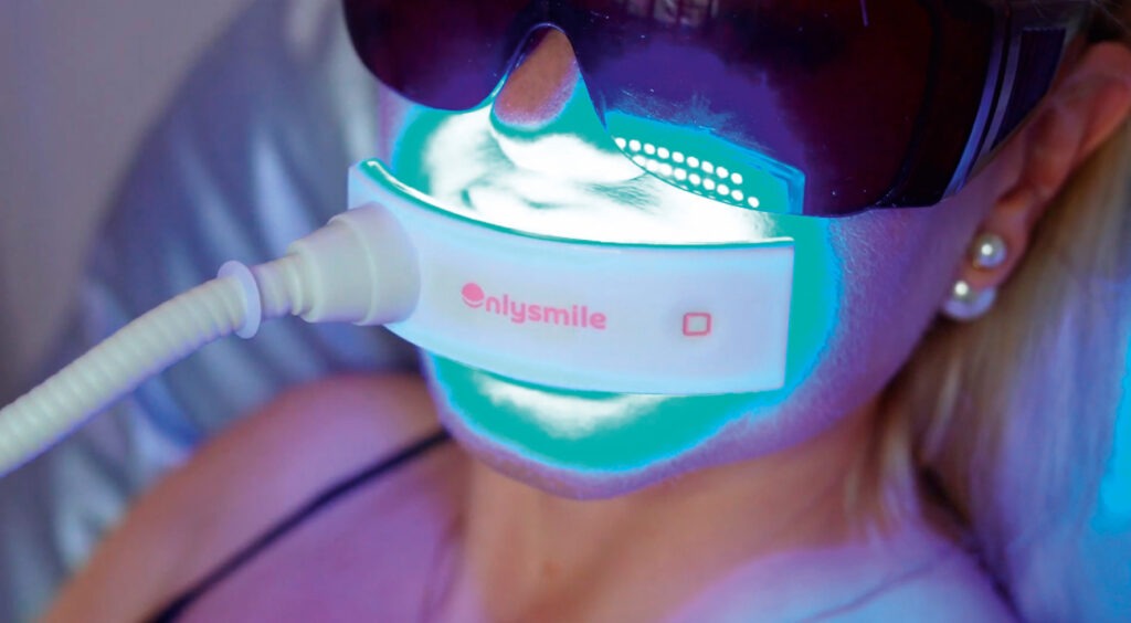 Onlysmile Zahnaufhellung (c) by Onlysmile