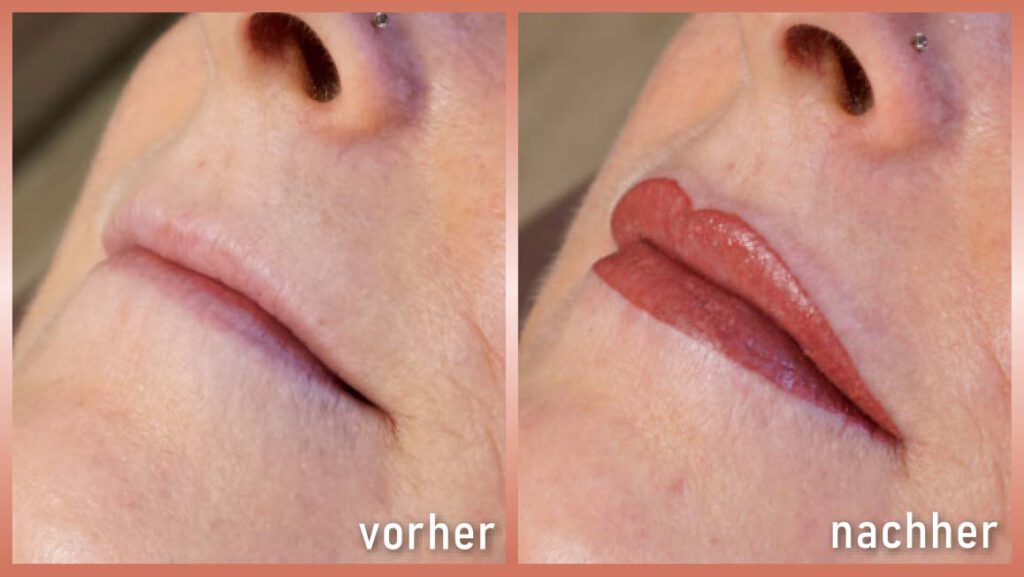 Lippenkontur Korrektur Permanent Make-Up vorher-nachher Foto 2