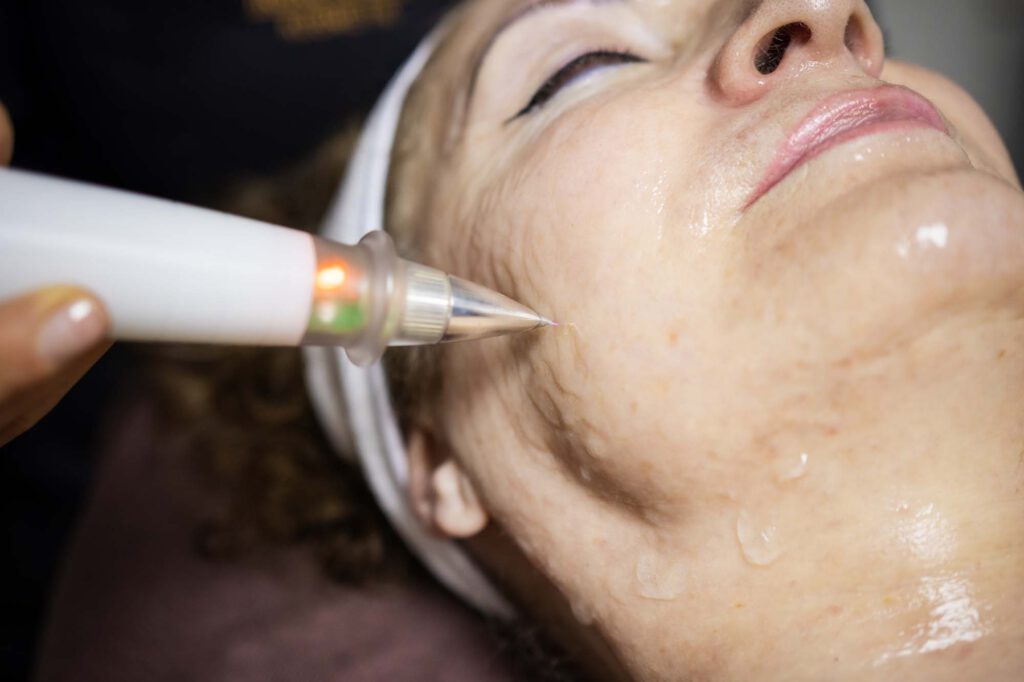 IKosmetik Behandlung Kaltplasma Foto