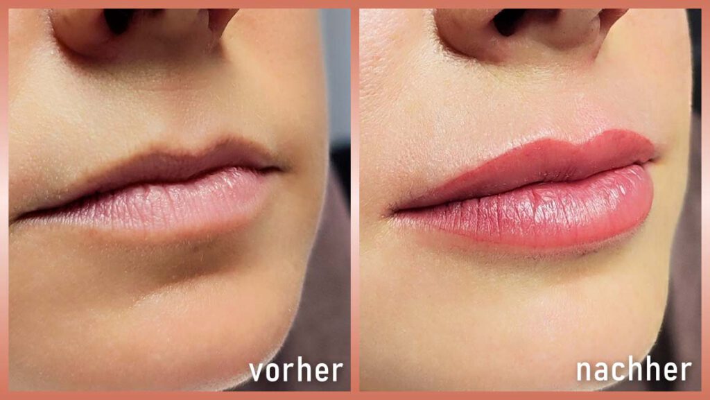 Permanent Make-Up Aquarelllippen Vorher-Nachher von der Seite
