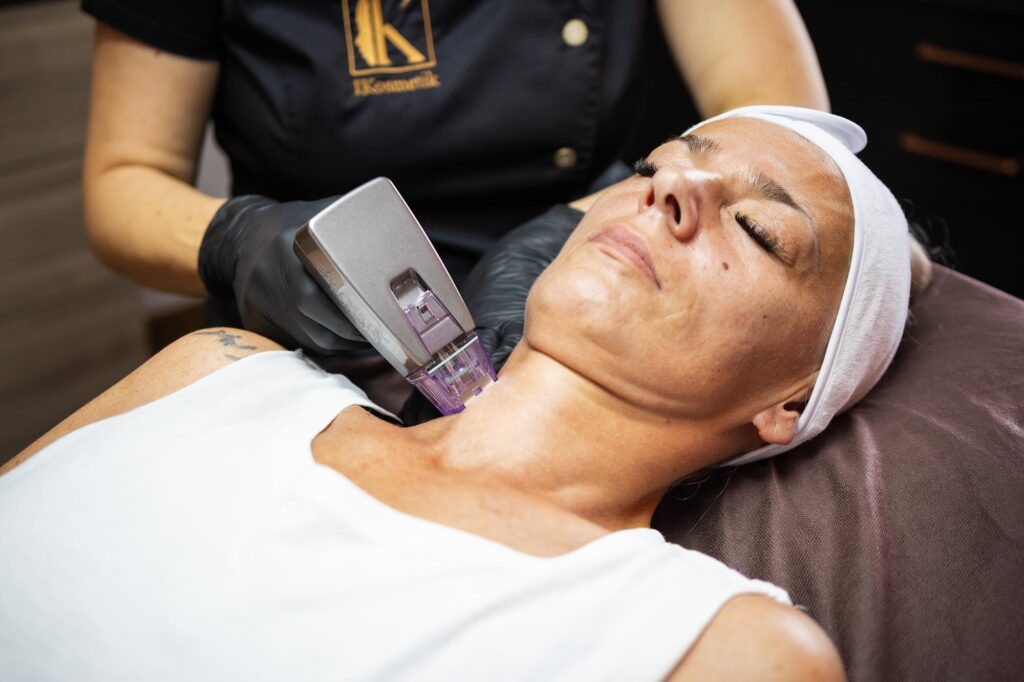 Radiofrequenz Microneedling Hals