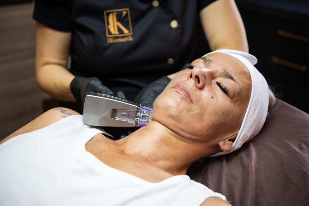 Radiofrequenz Microneedling Hals