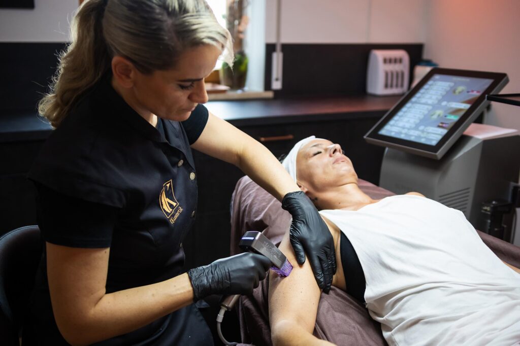 Radiofrequenz Microneedling Oberarm