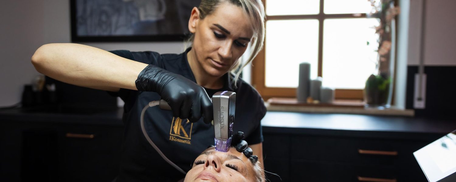 Radiofrequenz Microneedling Gesicht